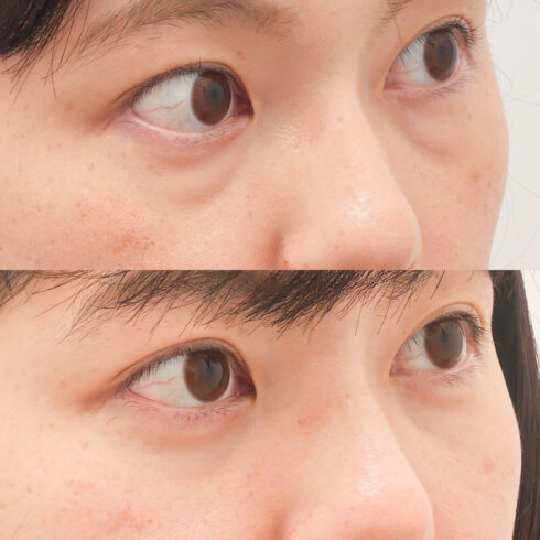 権東容秀医師 症例写真