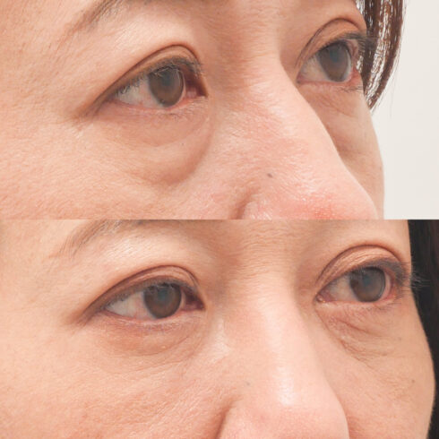 権東容秀医師 症例写真