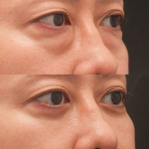 権東容秀医師 症例写真