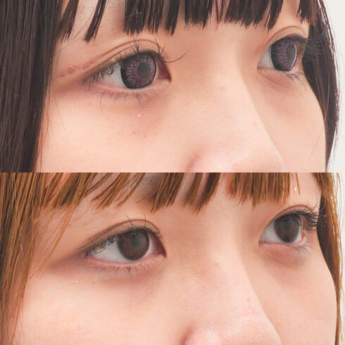 権東容秀医師 症例写真