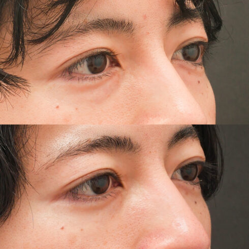 権東容秀医師 症例写真