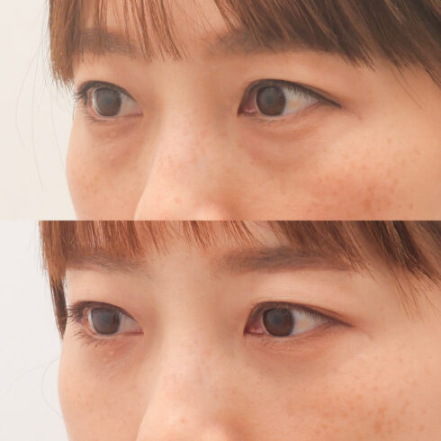 権東容秀医師 症例写真