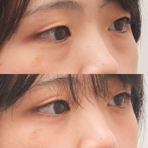 権東容秀医師 症例写真