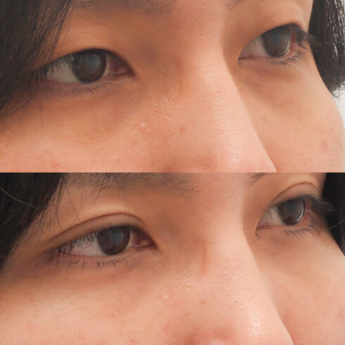 権東容秀医師 症例写真