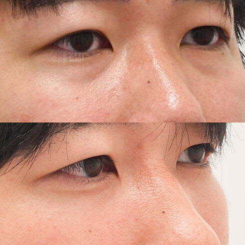 権東容秀医師 症例写真