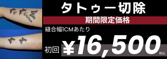 タトゥー除去 期間限定価格 縫合幅1CMあたり 初回¥16,500税込