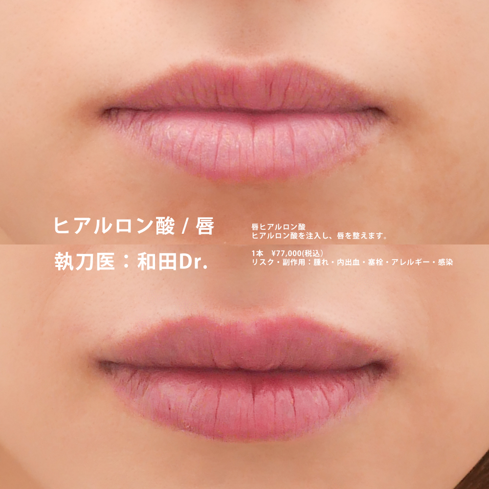 和田医師の症例写真