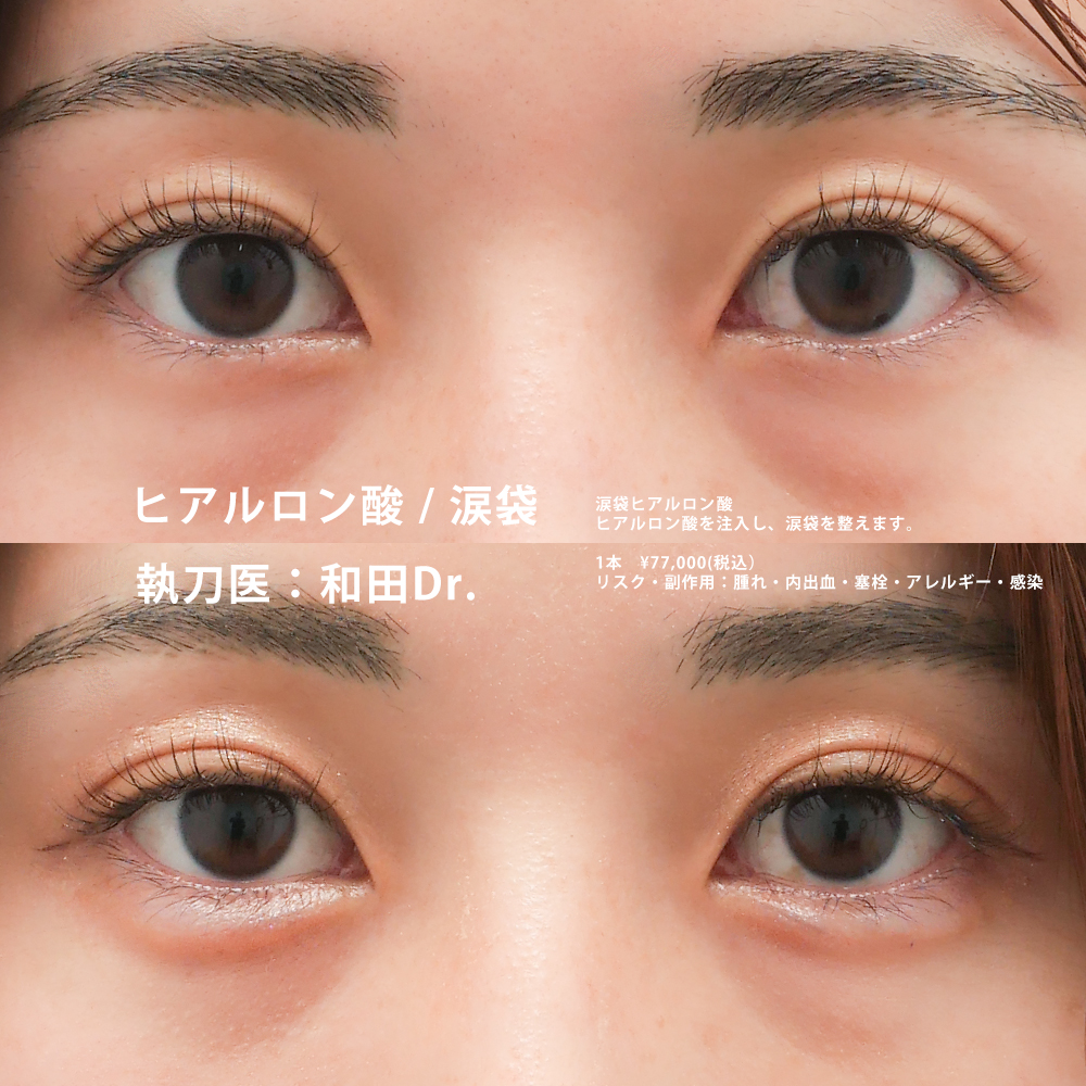 和田医師の症例写真