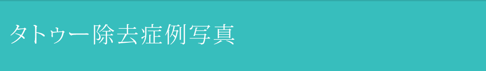 MV